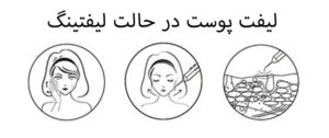 لیفت پوست با اتوی صورت
